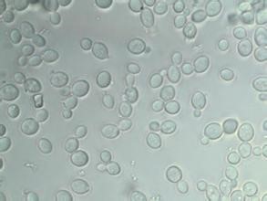 ICAB 10281 Saccharomyces cerevisiae ester prominent