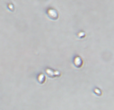 ICAB 10279 Abnormal Wickham yeast has high tolerance