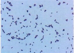 ICAB 2012 Lactobacillus plantarum has high malic-lactic acid conversion and degrades bioamines